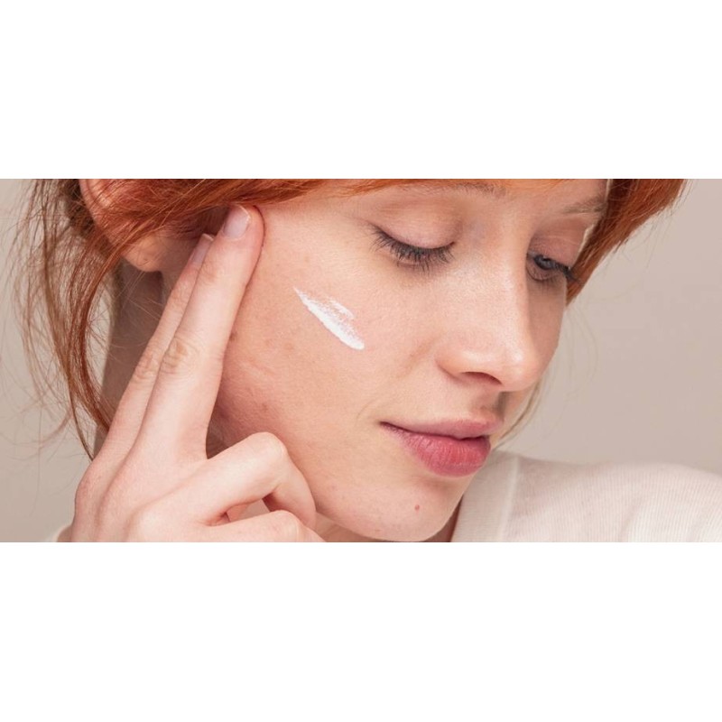 Isdin Fotoultra 100 Spot Prevent