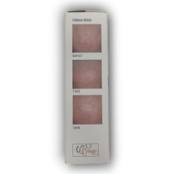 Isdin Eryfotona Ak-nmsc Fluid 50 Ml