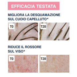 Ist. Ganassini Rilastil Difesa Dermatite Seborroica Gel Lenitivo Sebonormalizzante 30 Ml