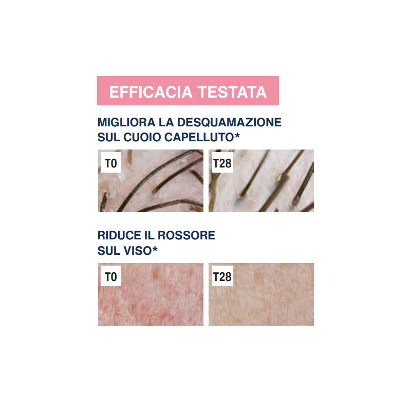 Ist. Ganassini Rilastil Difesa Dermatite Seborroica Gel Lenitivo Sebonormalizzante 30 Ml