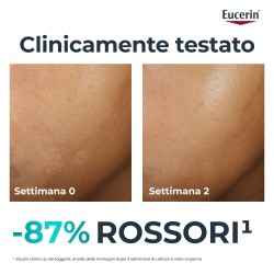 Beiersdorf Eucerin Dermopure Clinical Trattamento Lenitivo 40 Ml