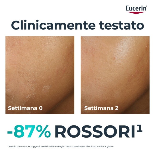 Beiersdorf Eucerin Dermopure Clinical Trattamento Lenitivo 40 Ml
