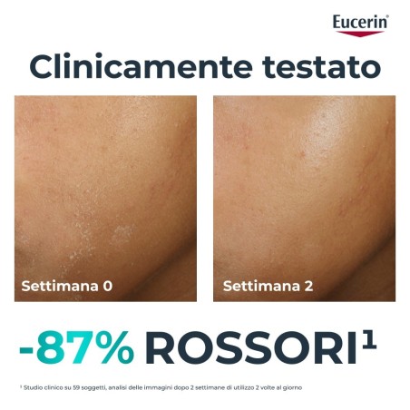 Beiersdorf Eucerin Dermopure Clinical Trattamento Lenitivo 40 Ml