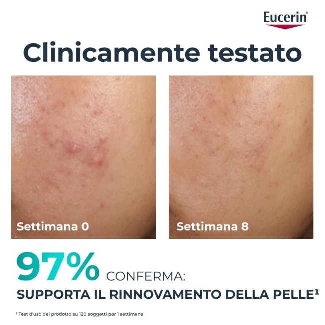 Beiersdorf Eucerin Dermopure Clinical Trattamento Rinnovatore 40 Ml