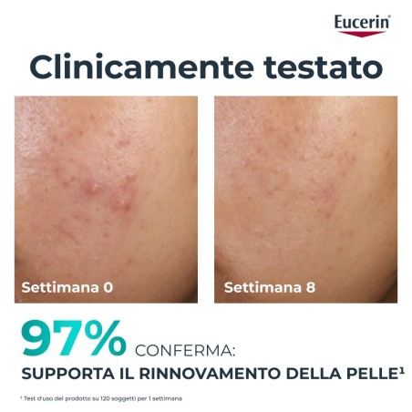 Beiersdorf Eucerin Dermopure Clinical Trattamento Rinnovatore 40 Ml