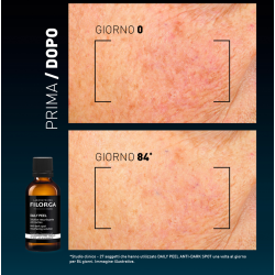FILORGA DAILY PEEL DARK SPOT 50 ML
