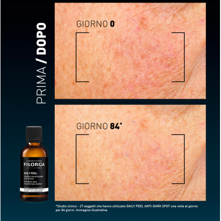 FILORGA DAILY PEEL DARK SPOT 50 ML