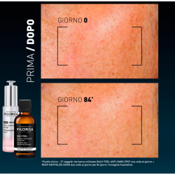 FILORGA DAILY PEEL DARK SPOT 50 ML