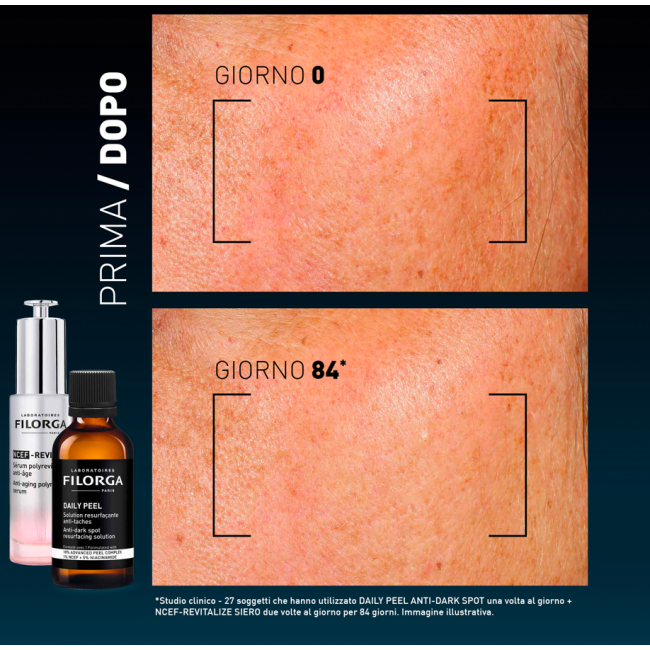 FILORGA DAILY PEEL DARK SPOT 50 ML