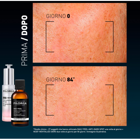 FILORGA DAILY PEEL DARK SPOT 50 ML
