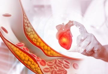 Colesterolo, i valori e a quale età iniziare a misurarlo